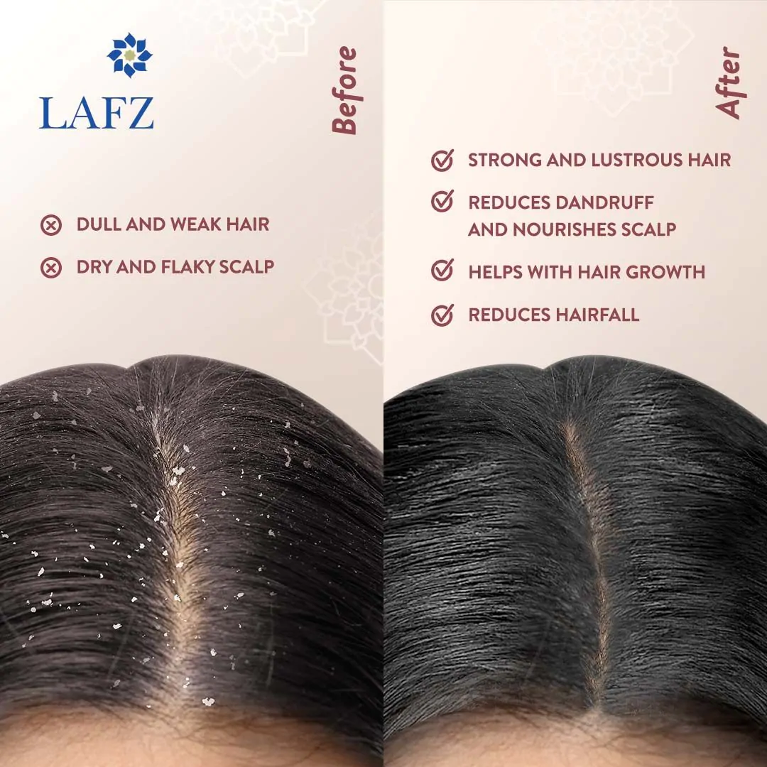 LAFZ Halal Onion Seed Essential Oil For Hair (6)
